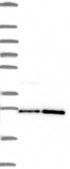 Anti-PGRMC1 antibody produced in rabbit Prestige Antibodies&#174; Powered by Atlas Antibodies, affinity isolated antibody, buffered aqueous glycerol solution