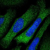 Anti-TARS antibody produced in rabbit Prestige Antibodies&#174; Powered by Atlas Antibodies, affinity isolated antibody, buffered aqueous glycerol solution