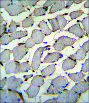 ANTI-DDX60L (C-TERM) antibody produced in rabbit IgG fraction of antiserum, buffered aqueous solution