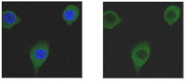 Anti-Transgelin/SM22a Antibody, clone 20F2.2 clone 20F2.2, from mouse