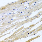 Anti-BNIP3 antibody produced in rabbit