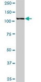 Anti-HIP1 antibody produced in mouse purified immunoglobulin, buffered aqueous solution