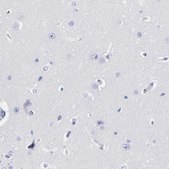 Anti-DCN antibody produced in rabbit Prestige Antibodies&#174; Powered by Atlas Antibodies, affinity isolated antibody, buffered aqueous glycerol solution