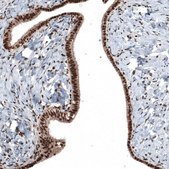 Anti-SP1 antibody produced in rabbit Prestige Antibodies&#174; Powered by Atlas Antibodies, affinity isolated antibody, buffered aqueous glycerol solution