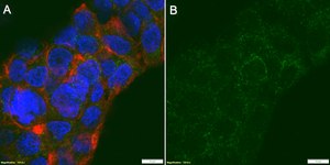 Anti-PNPLA3 Antibody, clone 11C5 ZooMAb&#174; Mouse Monoclonal recombinant, expressed in HEK 293 cells