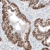 Anti-CDX2 antibody produced in mouse Prestige Antibodies&#174; Powered by Atlas Antibodies, clone CL12967, purified by using Protein A, buffered aqueous glycerol solution