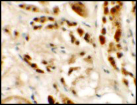 Anti-SIGLEC15 antibody produced in rabbit affinity isolated antibody