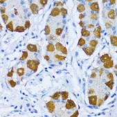 Anti-POLB antibody produced in rabbit