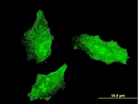 Monoclonal Anti-MKI67 antibody produced in mouse clone 7B8, purified immunoglobulin, buffered aqueous solution