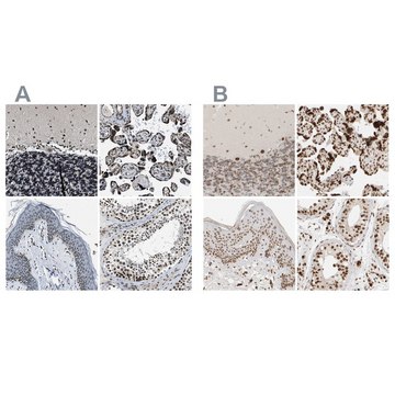Anti-ZC3HC1 antibody produced in rabbit Prestige Antibodies&#174; Powered by Atlas Antibodies, affinity isolated antibody, buffered aqueous glycerol solution