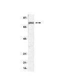 Anti-MeCP2 Antibody Upstate&#174;, from rabbit
