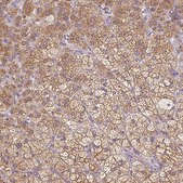 Anti-SOAT1 antibody produced in rabbit Prestige Antibodies&#174; Powered by Atlas Antibodies, affinity isolated antibody, buffered aqueous glycerol solution