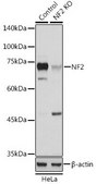 Anti- NF2 antibody produced in rabbit