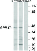 Anti-GPR87 antibody produced in rabbit affinity isolated antibody