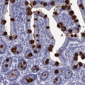 Anti-TFF3 antibody produced in rabbit Prestige Antibodies&#174; Powered by Atlas Antibodies, affinity isolated antibody, buffered aqueous glycerol solution