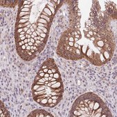 Anti-RANBP3L antibody produced in rabbit Prestige Antibodies&#174; Powered by Atlas Antibodies, affinity isolated antibody, buffered aqueous glycerol solution