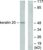 Anti-Keratin 20 antibody produced in rabbit affinity isolated antibody