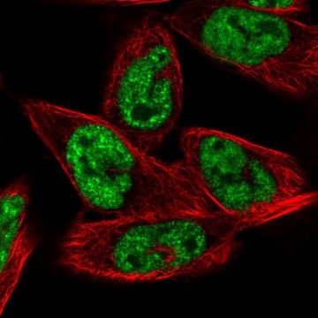 Anti-MORF4L1 antibody produced in rabbit Prestige Antibodies&#174; Powered by Atlas Antibodies, affinity isolated antibody