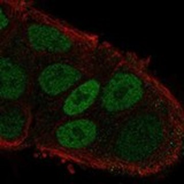 Anti-MYO6 antibody produced in rabbit Prestige Antibodies&#174; Powered by Atlas Antibodies, affinity isolated antibody, buffered aqueous glycerol solution