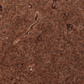 Monoclonal Anti-Adam10 Antibody Produced In Mouse Prestige Antibodies&#174; Powered by Atlas Antibodies, clone CL13814, affinity isolated antibody, buffered aqueous glycerol solution