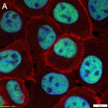 Anti-TP63 Antibody, clone 1E14 ZooMAb&#174; Rabbit Monoclonal recombinant, expressed in HEK 293 cells