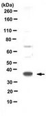 Anti-HSD17B7 Antibody