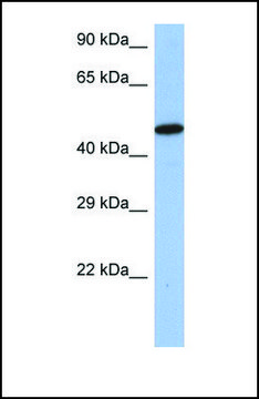Anti-IRF5 antibody produced in rabbit affinity isolated antibody