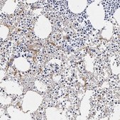 Anti-ITGA2B antibody produced in rabbit Prestige Antibodies&#174; Powered by Atlas Antibodies, affinity isolated antibody, buffered aqueous glycerol solution