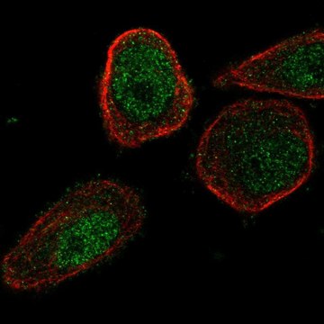 Anti-CHML antibody produced in rabbit Prestige Antibodies&#174; Powered by Atlas Antibodies, affinity isolated antibody, buffered aqueous glycerol solution