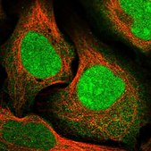 Anti-CCDC82 antibody produced in rabbit Prestige Antibodies&#174; Powered by Atlas Antibodies, affinity isolated antibody, buffered aqueous glycerol solution