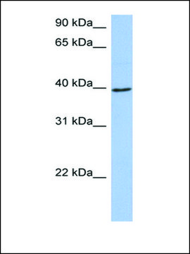 Anti-ACADM antibody produced in rabbit affinity isolated antibody