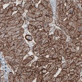 Monoclonal Anti-LAMB2 antibody produced in mouse Prestige Antibodies&#174; Powered by Atlas Antibodies, clone CL2976, purified immunoglobulin, buffered aqueous glycerol solution