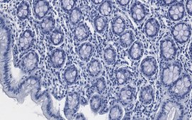 Anti-Tubulin &#947;-2 Antibody, clone 1M19 ZooMAb&#174; Rabbit Monoclonal recombinant, expressed in HEK 293 cells
