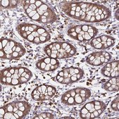 Anti-TXN antibody produced in rabbit Prestige Antibodies&#174; Powered by Atlas Antibodies, affinity isolated antibody, buffered aqueous glycerol solution