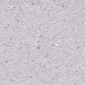 Anti-ZP3 antibody produced in rabbit Prestige Antibodies&#174; Powered by Atlas Antibodies, affinity isolated antibody, buffered aqueous glycerol solution