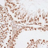 Anti-Histone H2AX antibody produced in rabbit