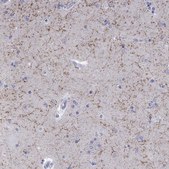 Anti-LAMP5 antibody produced in rabbit Prestige Antibodies&#174; Powered by Atlas Antibodies, affinity isolated antibody, buffered aqueous glycerol solution