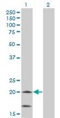 Monoclonal Anti-NDUFS4, (C-terminal) antibody produced in mouse clone 1A1, ascites fluid