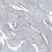 Anti-MYH11 antibody produced in rabbit Prestige Antibodies&#174; Powered by Atlas Antibodies, affinity isolated antibody, buffered aqueous glycerol solution