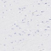 Anti-S100A12 antibody produced in rabbit Prestige Antibodies&#174; Powered by Atlas Antibodies, affinity isolated antibody, buffered aqueous glycerol solution