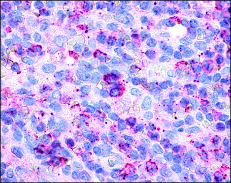 Anti-P2RY6 / P2Y6 antibody produced in rabbit affinity isolated antibody