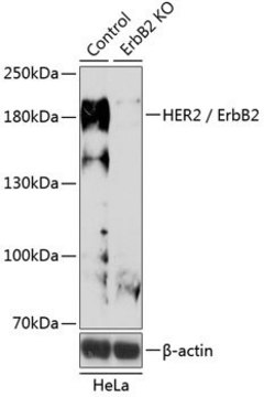 Anti-HER2/ERBB2 antibody produced in rabbit