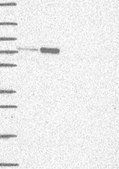 Anti-KIF22 antibody produced in rabbit Prestige Antibodies&#174; Powered by Atlas Antibodies, affinity isolated antibody, buffered aqueous glycerol solution
