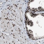 Anti-LMNA antibody produced in rabbit affinity isolated antibody, buffered aqueous glycerol solution