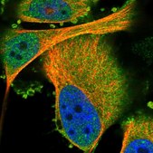 Anti-PRKCH antibody produced in rabbit Prestige Antibodies&#174; Powered by Atlas Antibodies, affinity isolated antibody, buffered aqueous glycerol solution