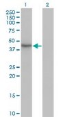 Monoclonal Anti-HDAC11 antibody produced in mouse clone 1C2-2G5, purified immunoglobulin, buffered aqueous solution