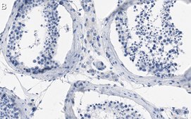 Anti-VE-Cadherin Antibody, clone 1O12 ZooMAb&#174; Rabbit Monoclonal recombinant, expressed in HEK 293 cells