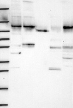 Anti-WDR3 antibody produced in rabbit Prestige Antibodies&#174; Powered by Atlas Antibodies, affinity isolated antibody, buffered aqueous glycerol solution