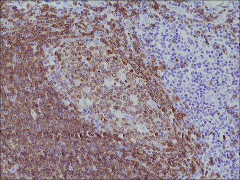 Anti-CD79a (C-term) antibody, Rabbit Monoclonal recombinant, expressed in HEK 293 cells, clone RM297, purified immunoglobulin