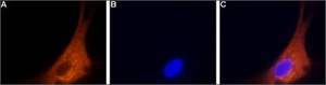 Anti-Calcium Channel (&#945;1B Subunit) (N-type of Voltage-gated Ca2+ Channel) antibody produced in rabbit affinity isolated antibody, lyophilized powder